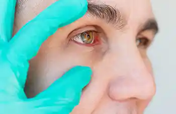 glaucoma specialists in kolkata