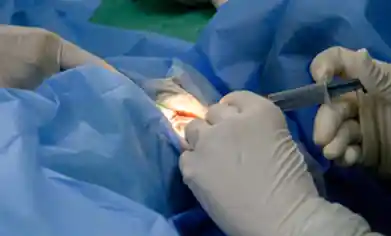 cataract eye treatment in kolkata