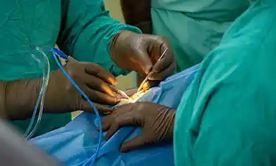 best cataract operation in kolkata