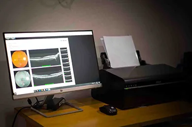 Optical Coherence Tomography used for Vitreo-Retinal services at Renuka Eye Institute